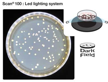 img/produkte/labm/scan100/darkfield-exemple.jpg