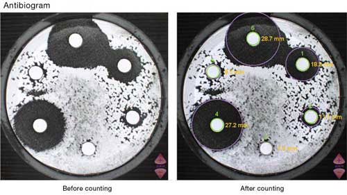 img/produkte/labm/scan1200/antibiogram.jpg