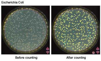img/produkte/labm/scan500/E-Coli-counting-thumb.jpg