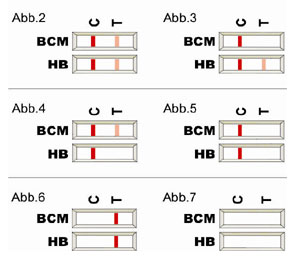 Auswertung des BCM-Tests