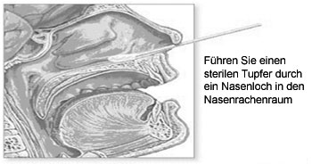 Durchfuehrung der Probenahme fuer den Keul-o-test Influenza A/B-Complete