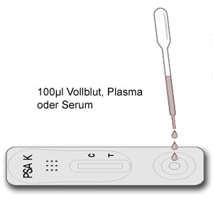 Durchfuehrung des qualitativen Keul-o-tests PSA