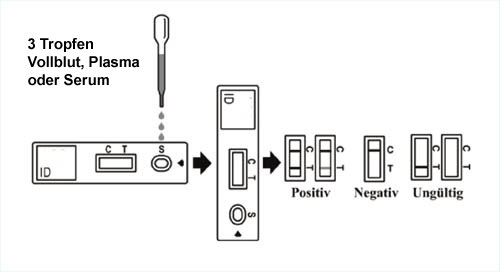 Durchfuehrung und Auswertung des Keul-o-tests RF