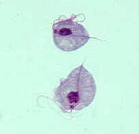 Mikroskopaufnahme von Trichomonas